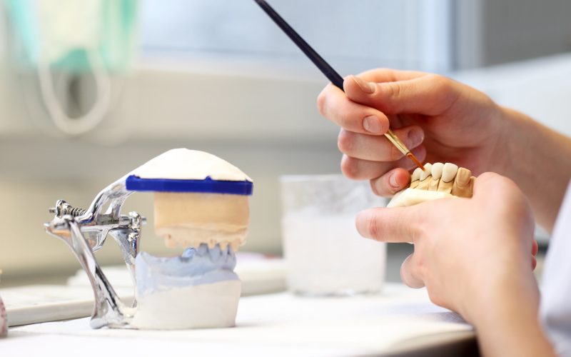 dental dentist objects implants