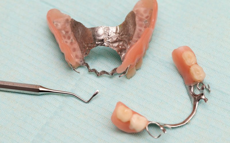 dental prostheses and ceramic covers for teeth